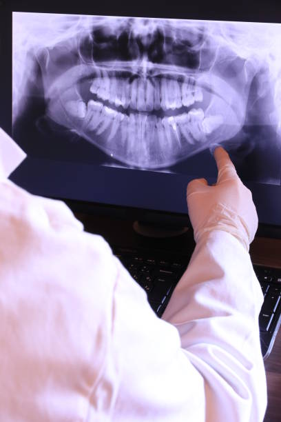 Best Pediatric Emergency Dentist in Califon, NJ
