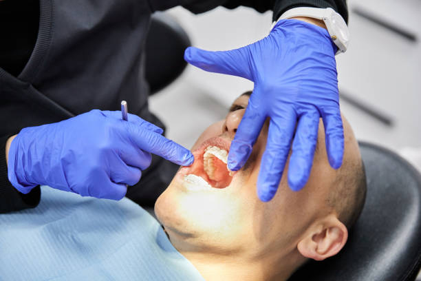 Best Broken or Cracked Tooth Emergency Dentist in Califon, NJ