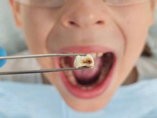 Best Mobile Emergency Dentist in Califon, NJ