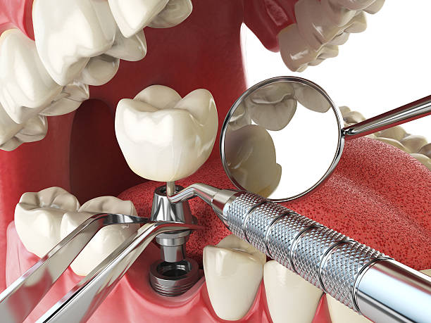 Best Emergency Dentist for Special Needs Patients in Califon, NJ